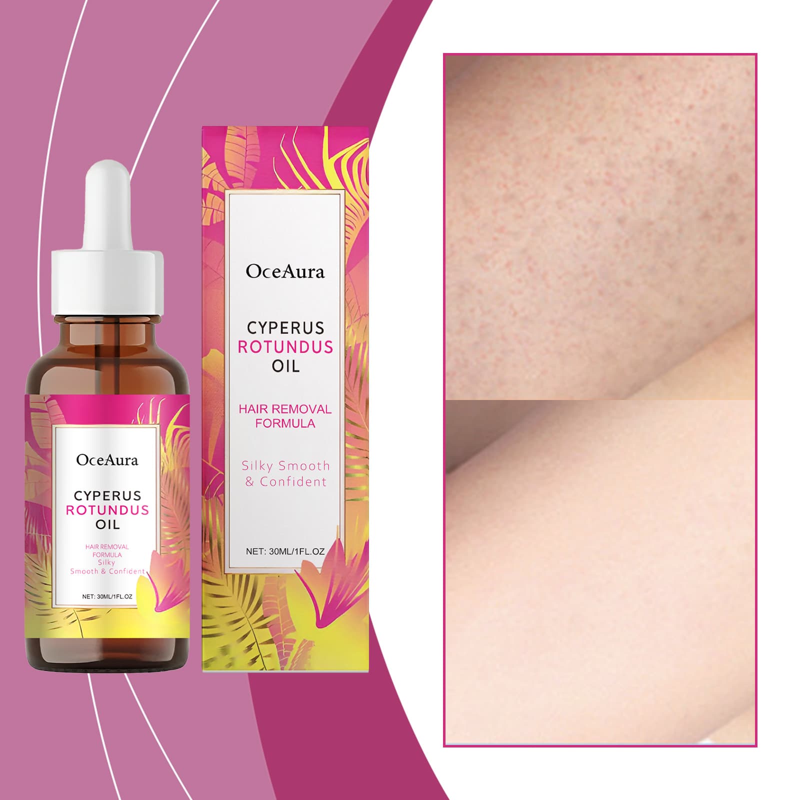 Haarentfernungs-Öl zur Beruhigung 30ml